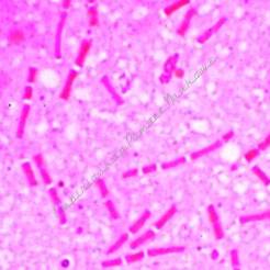 Bakterie - zestaw 25 preparatów GWARANCJA NAJNIŻSZEJ CENY